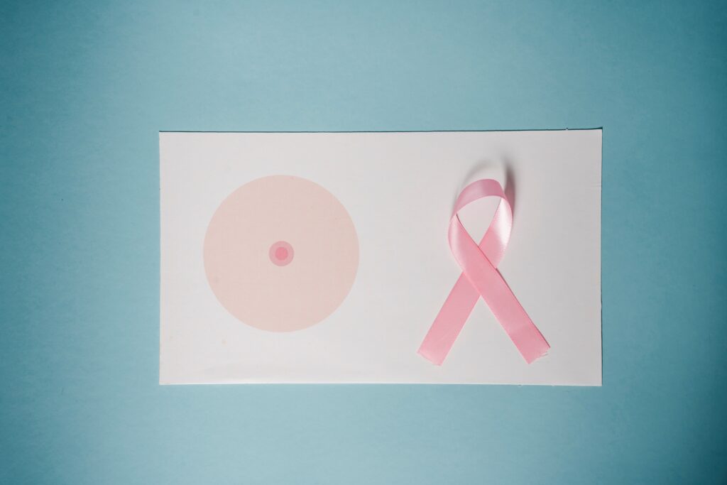 reconstrução de mama, câncer de mama, mastologia, mulher